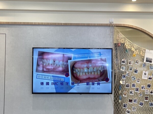 牙齒真的超重要｜台中北區植牙診所｜劉家齊醫生